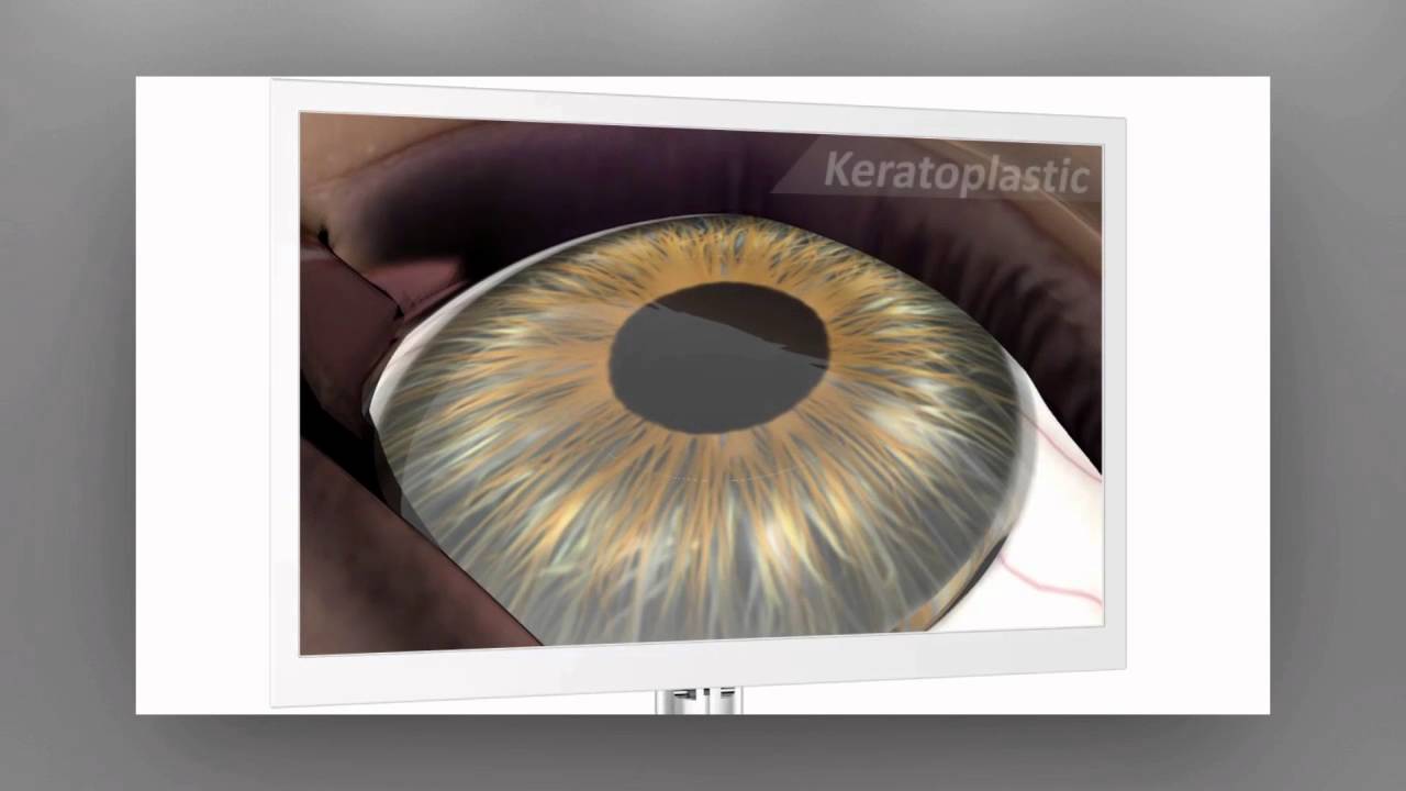 System Vision : Ziemer Femto LDV Z models