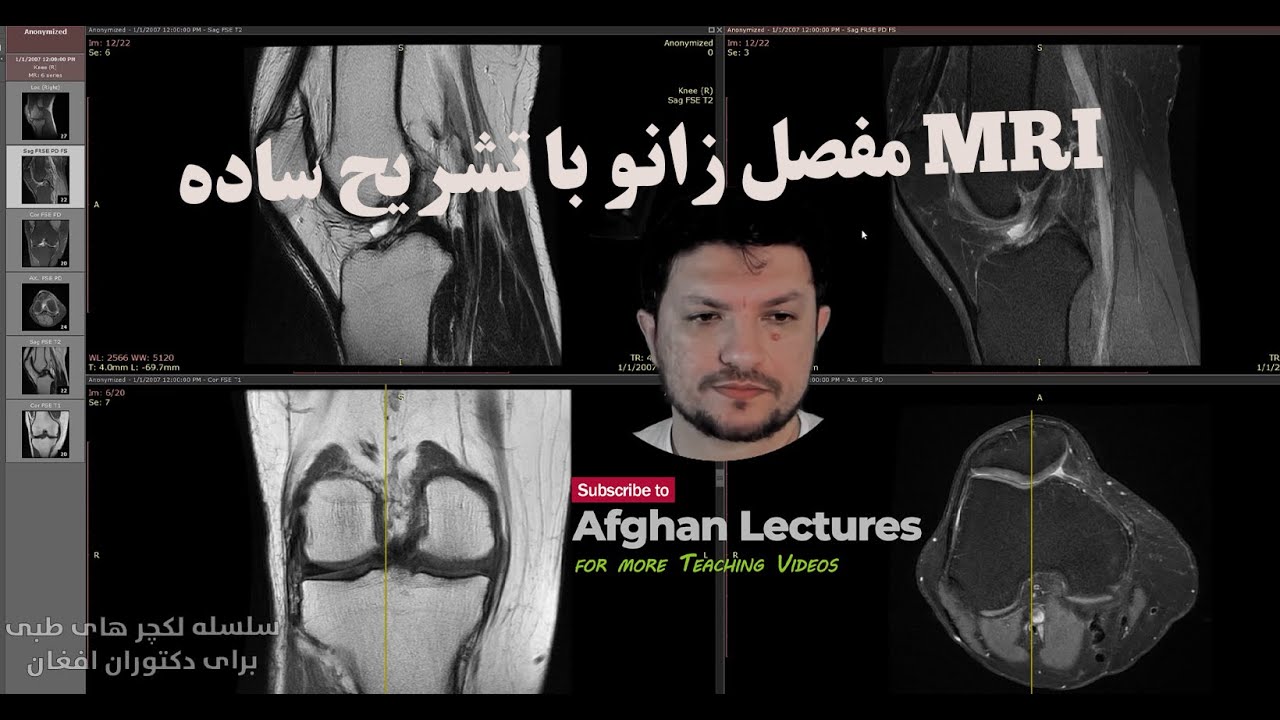 DR. MUSA DAWARI #MRI of #knee joint  ام آر آی مفصل زانو به شکل آسان برای همه بخصوص داکتران و محصلین