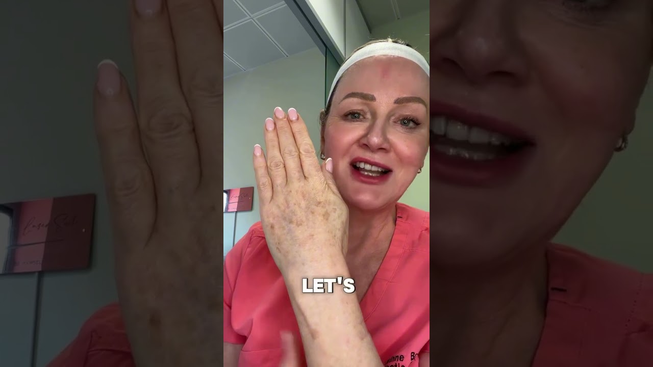 How to prevent sun spots (age spots) on the back of your hands or sun-exposed areas?