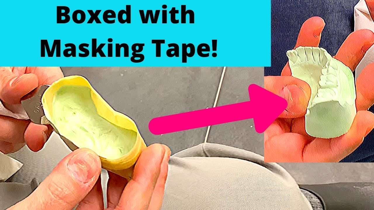 Rapid Dental Impression Boxing Technique - Prosthodontist Tip
