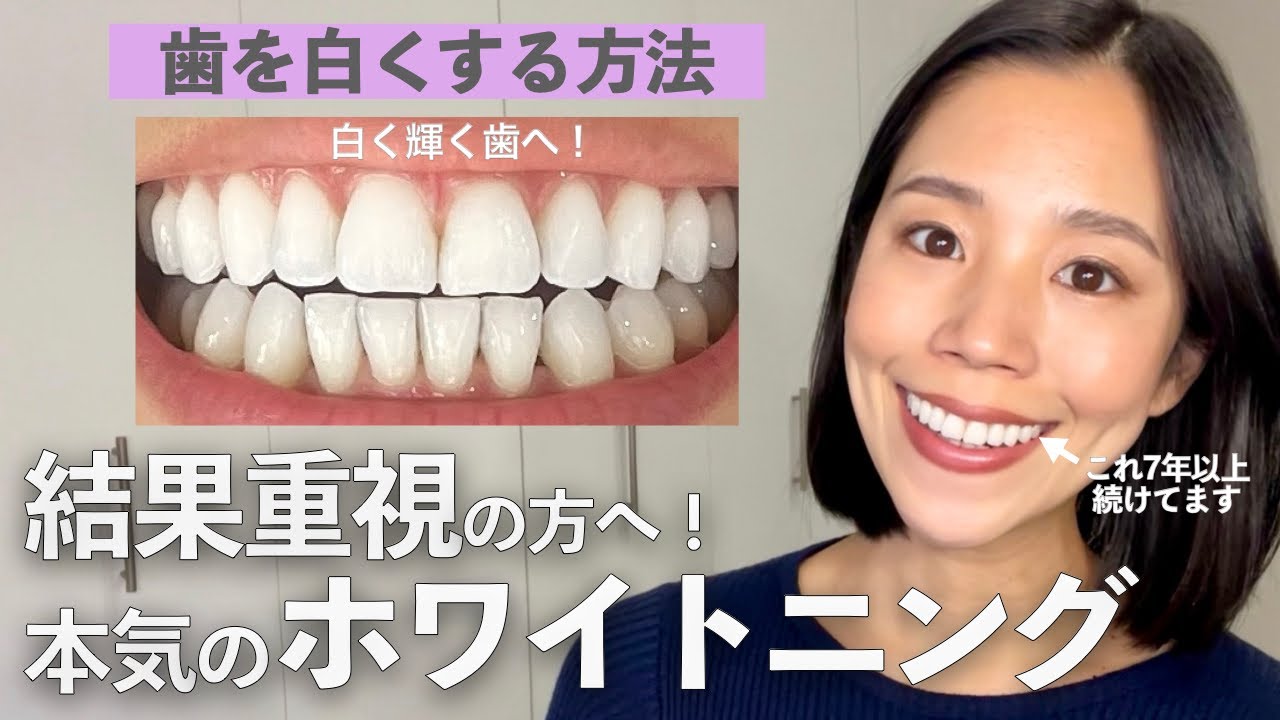 【保存版】これが自分でできる最強のホワイトニング方法です。この２つの組み合わせで歯が一番持続して白くなります！