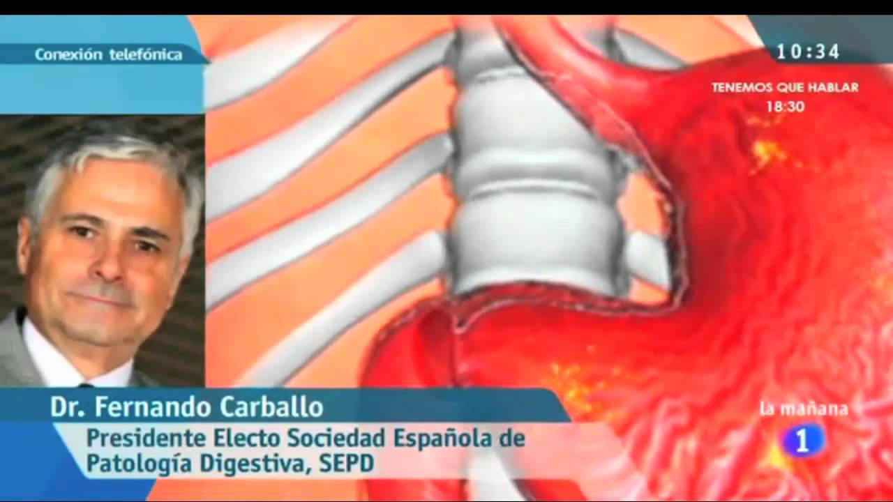 TVE LAS MAÑANAS DE LA 1 - Esofagitis eosinofílica