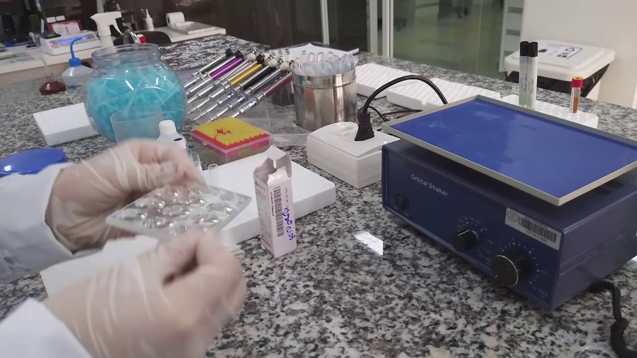 VDRL (sigla de Venereal Disease Research Laboratory)