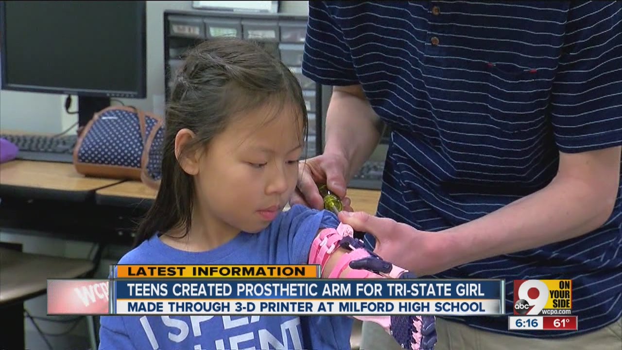 High schoolers make prosthetic arm... for $30