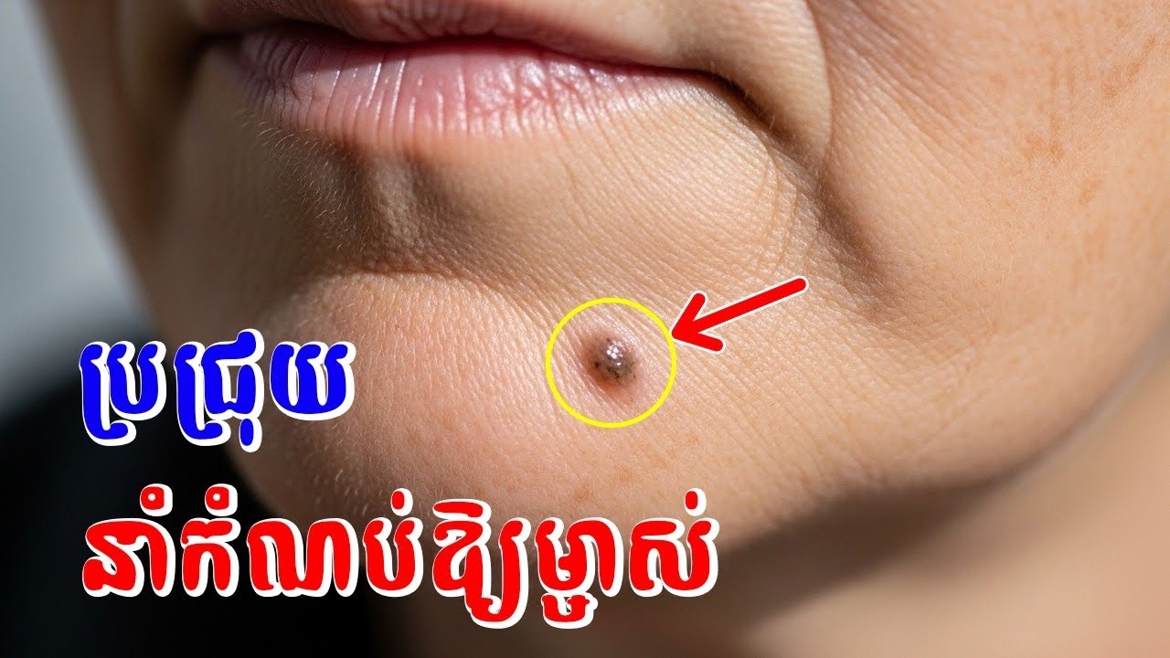 ប្រជ្រុយទាំង ៣ កន្លែងនាំកំណប់ឱ្យម្ចាស់ពេញមួយជីវិត