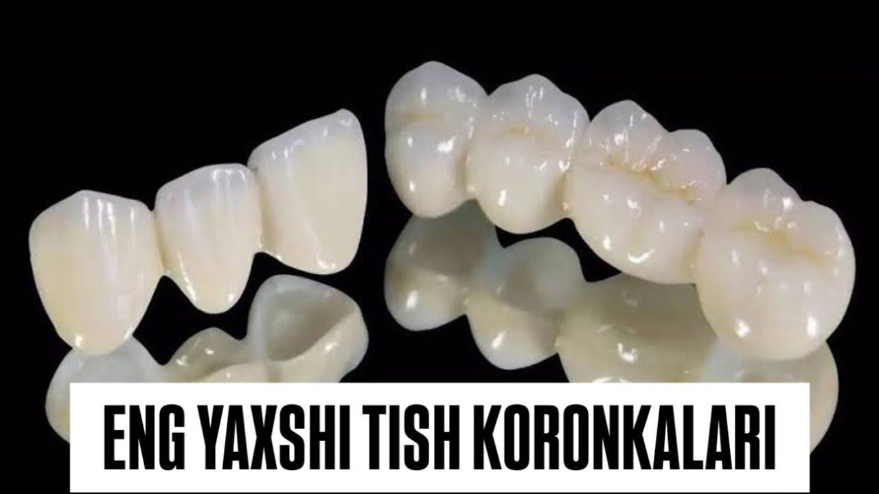 Eng yaxshi tish koronkalari #stomatolog#shifokor#tibbiyot#dentist# teeth#toothless 