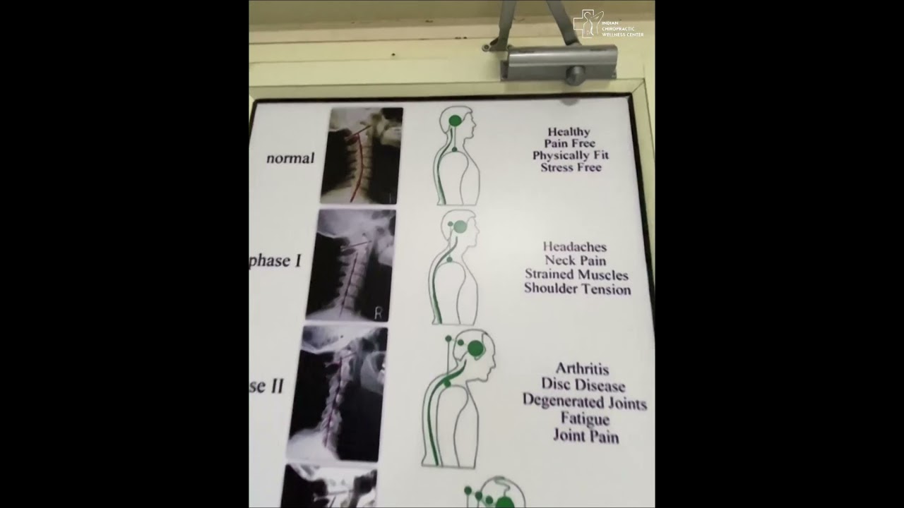 Chiropractic treatment in Surat - Indian Chiropractic Wellness Center-9662502748