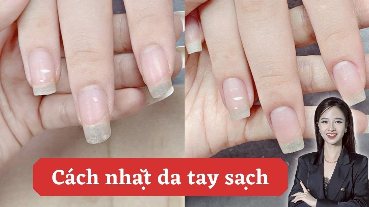 Cách nhặt da tay sạch
