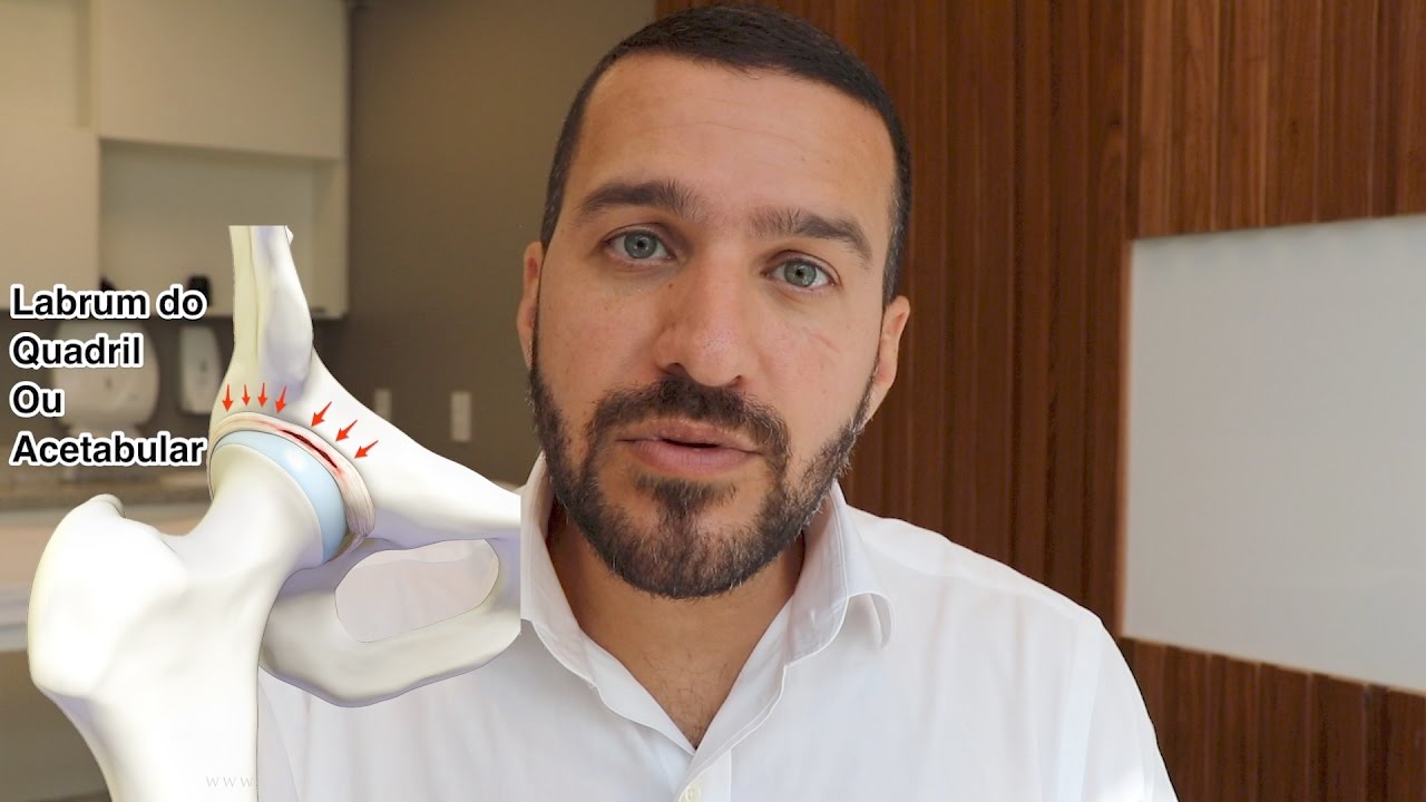 Lesão do Labrum Acetabular, cartilagem e o impacto femoroacetabular do quadril