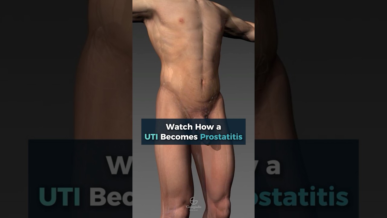 Watch How a UTI Becomes Prostatitis (3D Medical Animation)