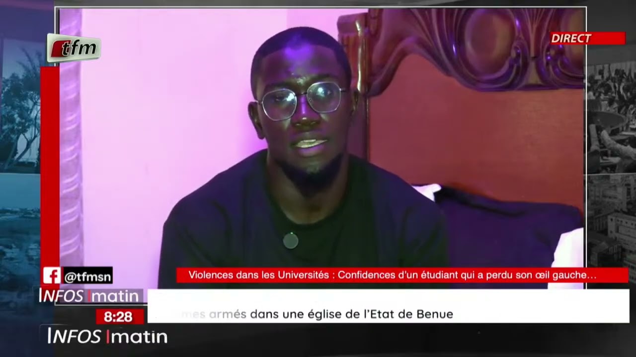 focus société | Violence dans les universités : confidences d'un étudiant qui a perdu son œil gauche