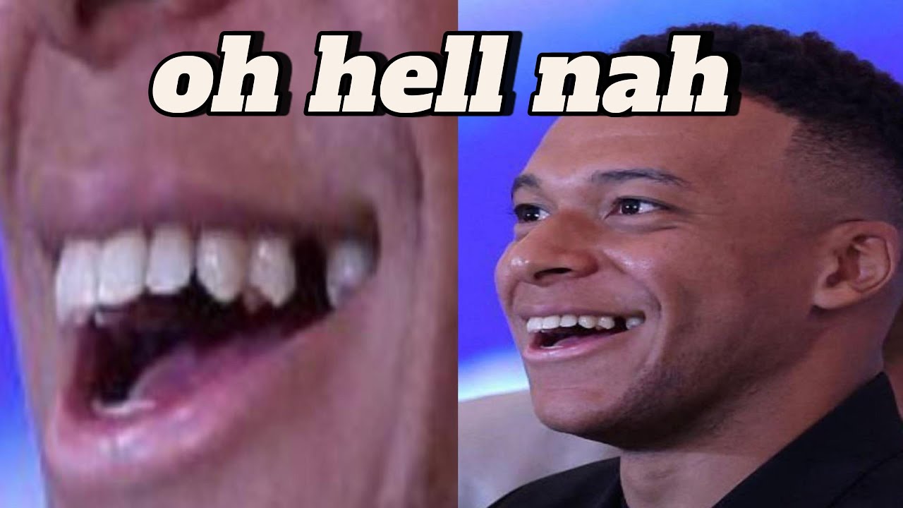 Mbappe's missing tooth🥀😭