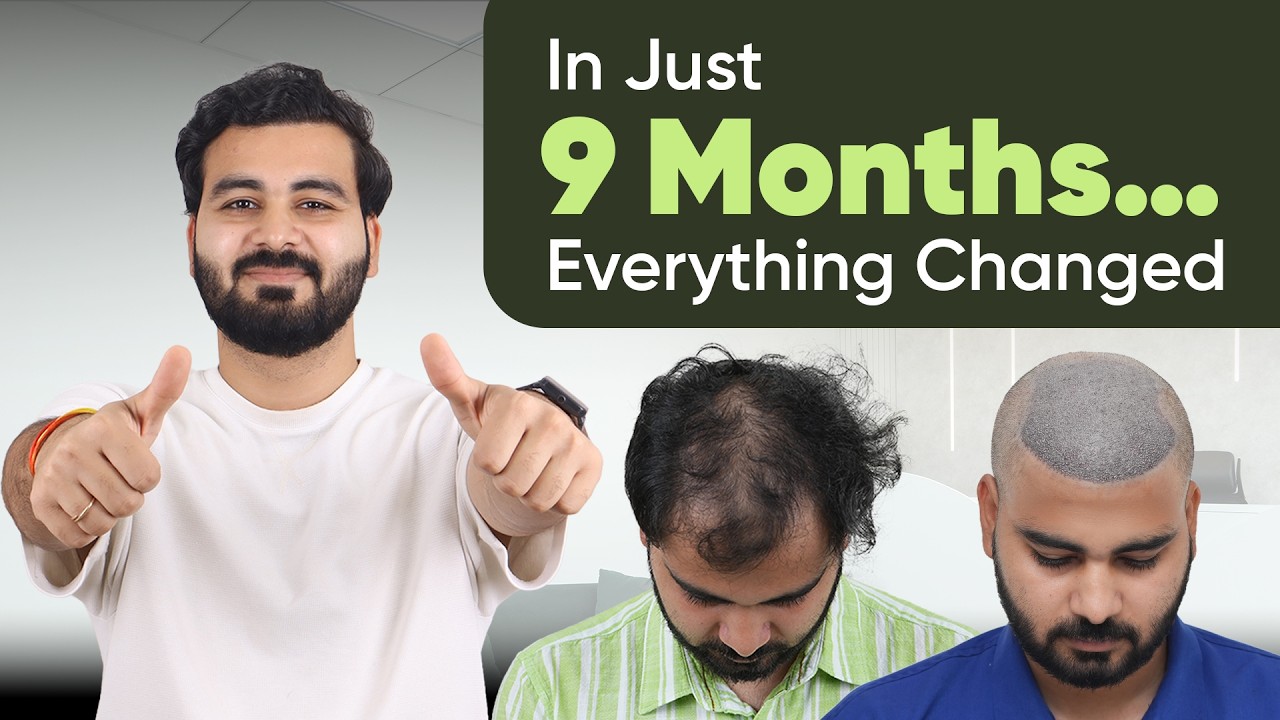 Hair Transplant in Ahmedabad (HX-AQGV) | Best Results & Cost of Hair Transplant in Ahmedabad.