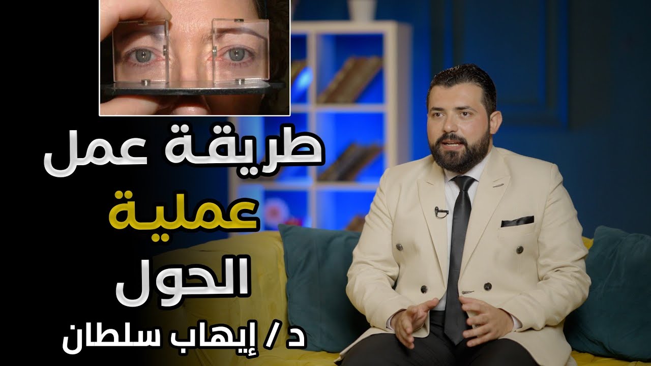 ازاي عملية الحول بتتعمل؟ /د. إيهاب سلطان