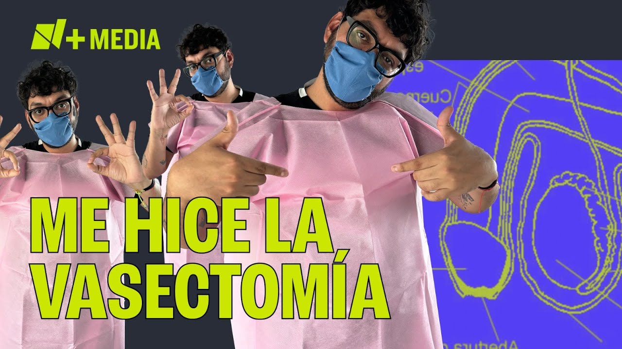 Vasectomía sin bisturí: mi experiencia personal