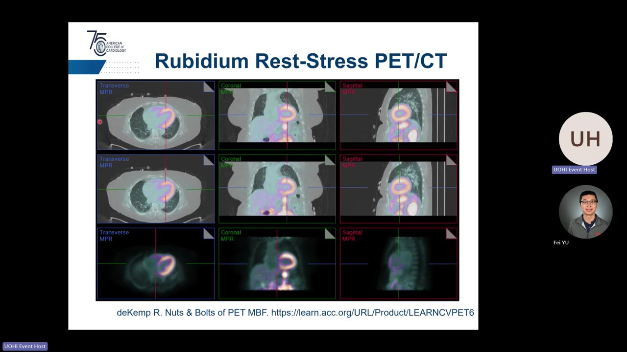 New Physics and AI Models for Rubidium PET in Cardiovascular Diseases - with Robert deKemp, PhD