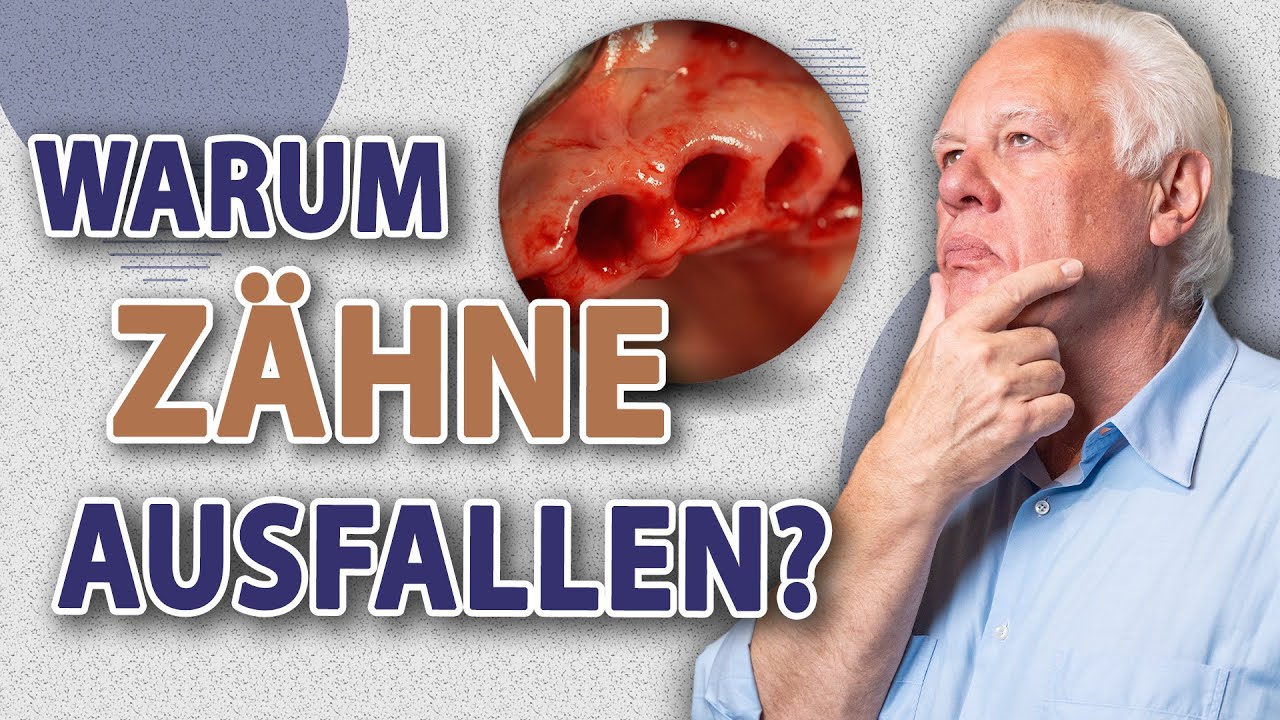 Darum wirst Du deine Zähne verlieren...
