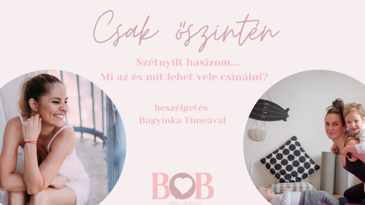 Szétnyílt hasizom....Mi az és mit lehet vele csinálni?
