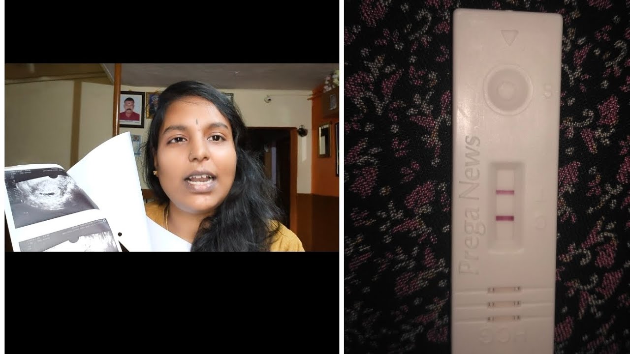 pregnancy journey part-1 (first scanning) / (ಮೊದಲ ಸ್ಕ್ಯಾನಿಂಗ್)