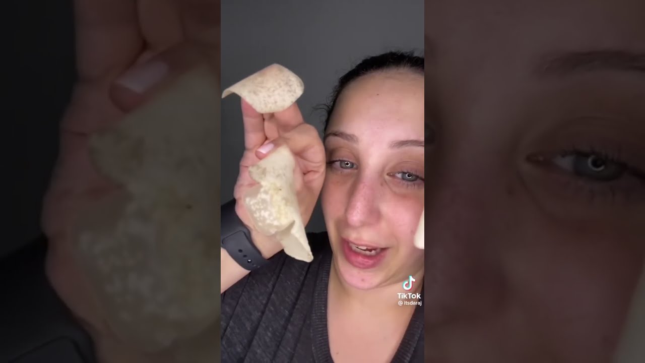 Hero Cosmetics Pimple Patches REMOVING MADNESS!