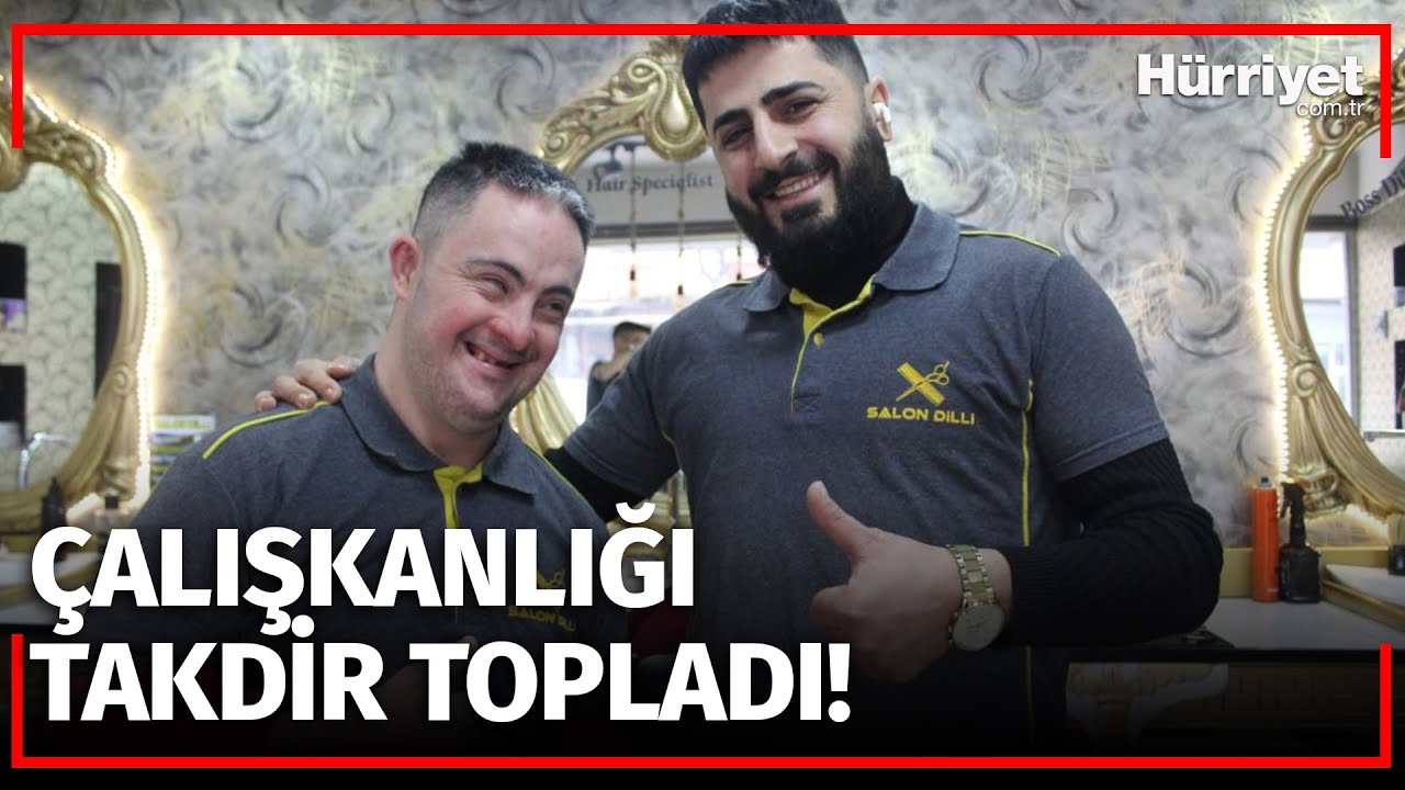 +1 Kromozomu Hayata Atılmasına Engel Olmadı