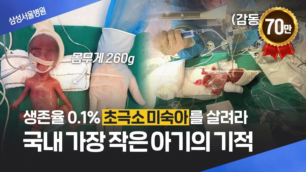 (감동실화) 260g 초극소 미숙아…“영화도 이렇게 만들면 안 믿을 듯” 생존율 0.1% 예랑이의 생명의 기적 이야기