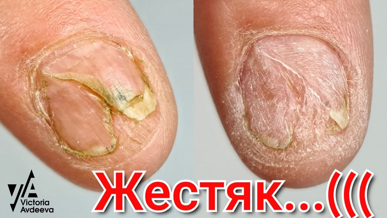 ПЕРЕВОПЛОЩЕНИЕ! ТАКОГО ВЫ ЕЩЕ НЕ ВИДЕЛИ! МАНИКЮР Виктория Авдеева
