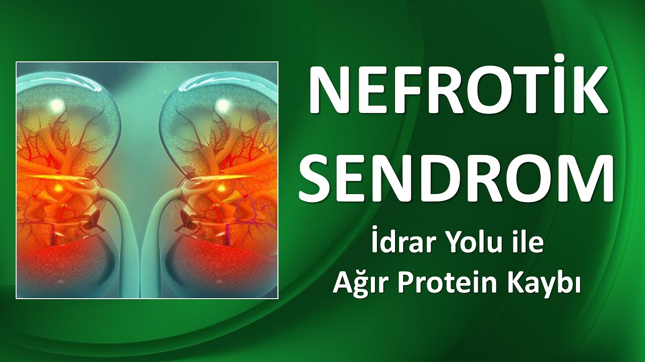 NEFROTİK SENDROM NEDİR? İdrar Yolu ile Ağır Protein Kaybı