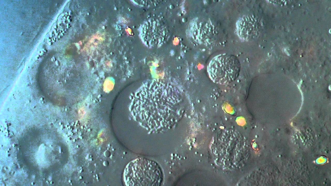 Paramecium caudatum cilia  - DIC microscope 1250x