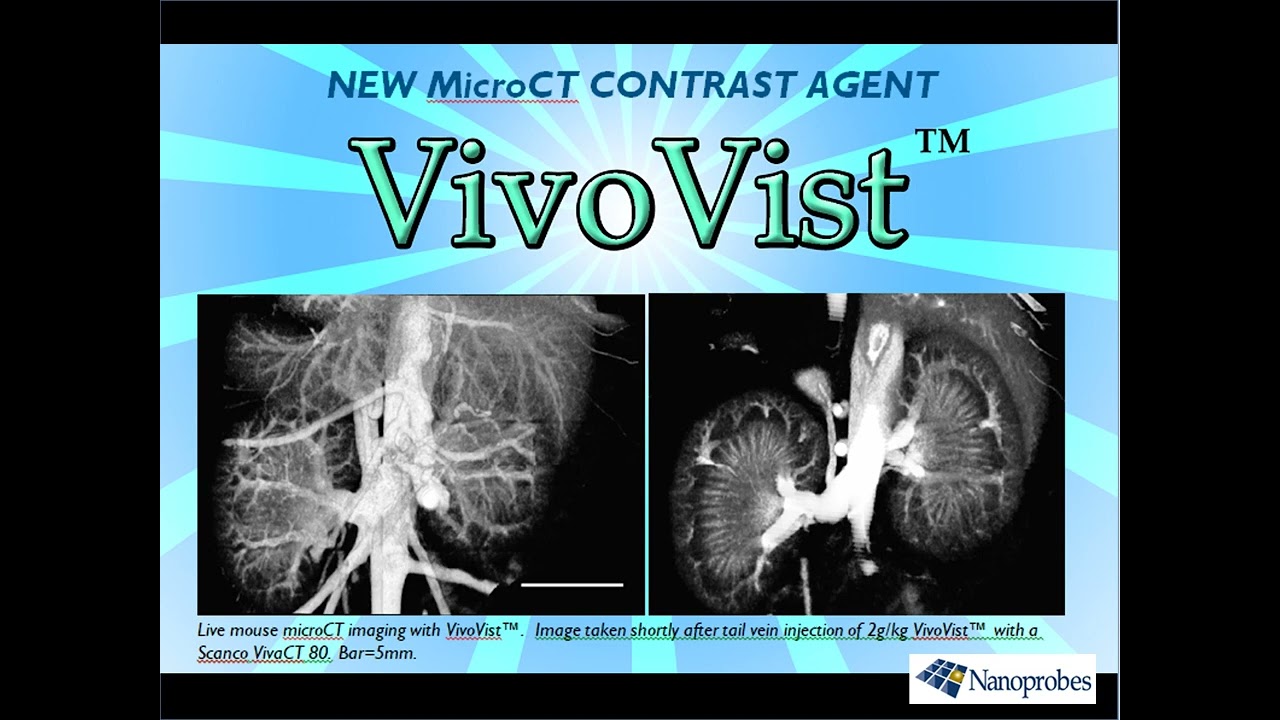 VivoVist&trade;: Reimagine Micro-CT