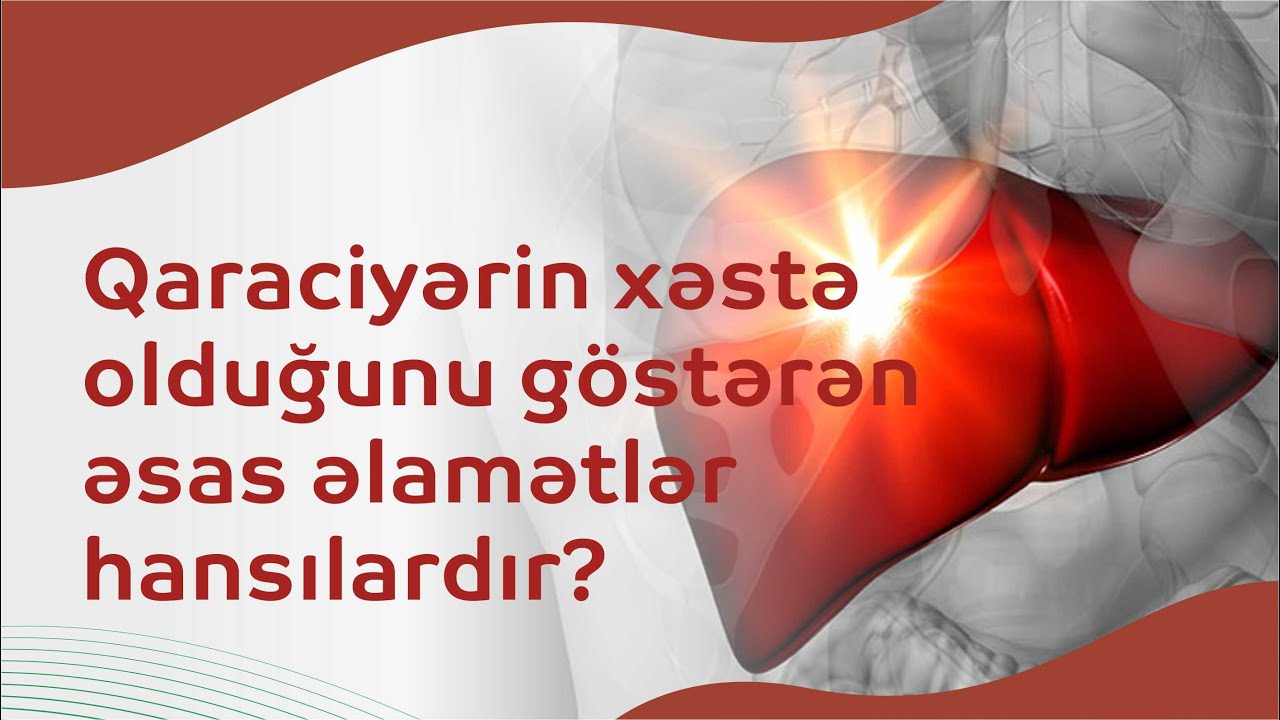 Qaraciyəri nələr zədələyir? Qaraciyərin xəstə olduğunu göstərən  əsas əlamətlər hansılardır?