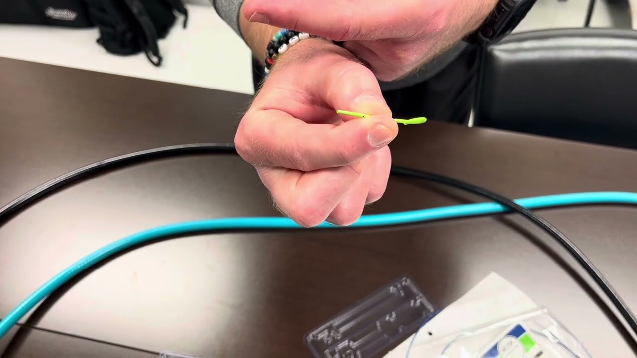 Pancreatic Duct Stent Placement