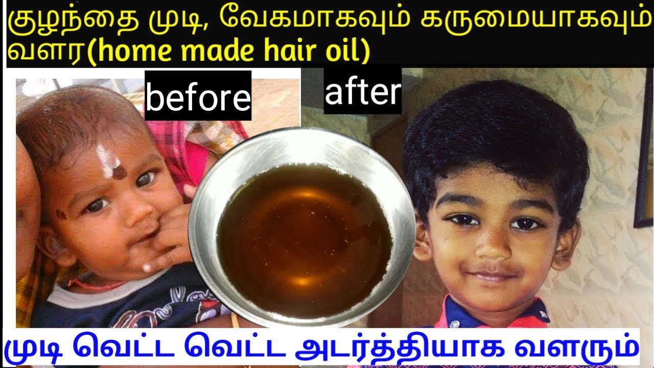 Homemade baby hair oil for long,thick,soft&healthy hair/fast hair growth oil for babies and kids