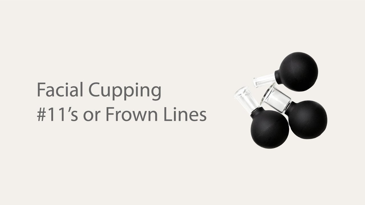 Facial cupping to reduce #11's or frown lines!