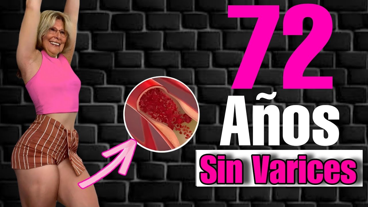 Adiós Varices Sin Importar tu Edad: LA FORMULA SECRETA🧪