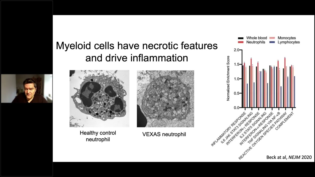 VEXAS - Learning from somatic diseases | Tuesday Lunch with RITA