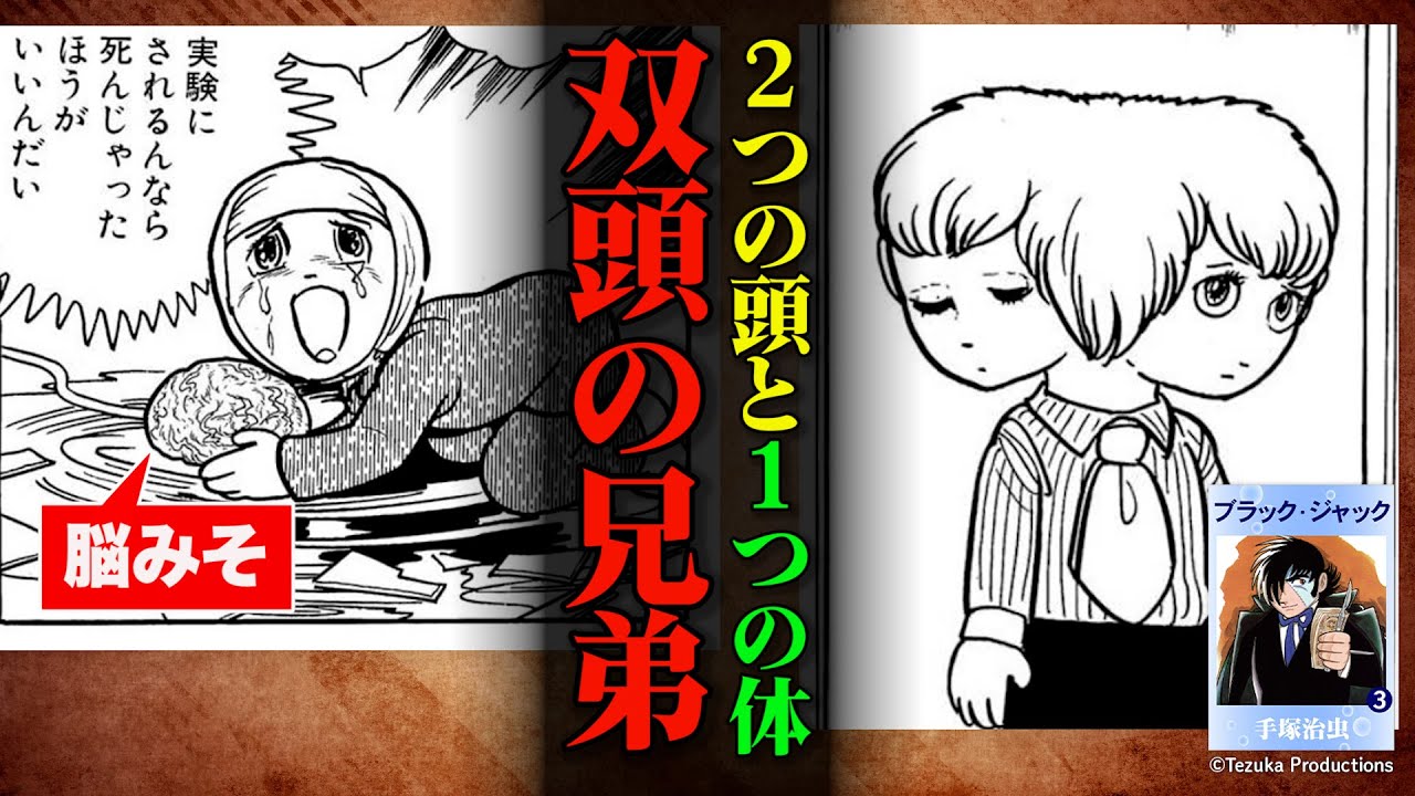 結合双生児の闇「ブラックジャック」天才・手塚治虫　医療界へのアンチテーゼとなった問題回