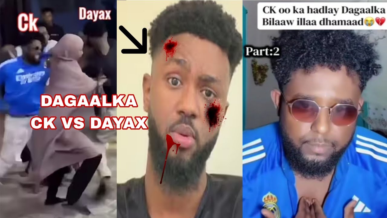 DAGAAL KA CK IYO DAYAX DALNUURSHE SIDUU U DHACAY CK OO KA HADLAYA DAAWO YAA GARDARAN?