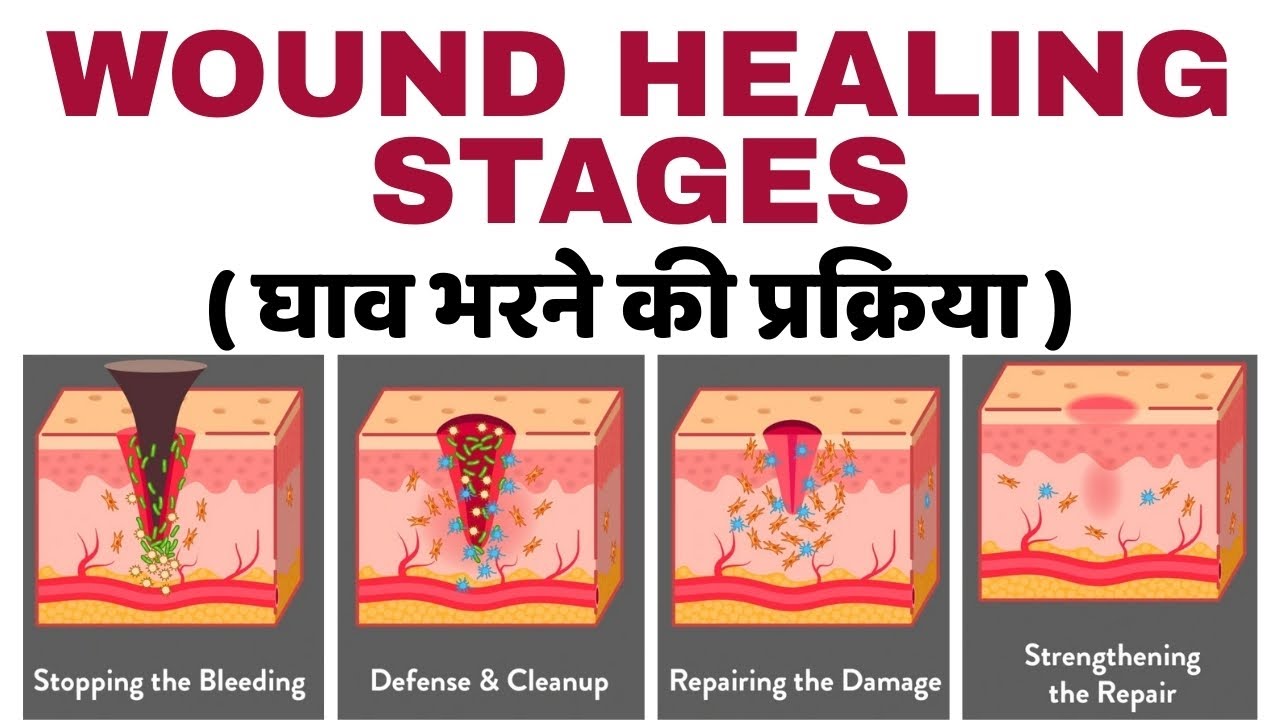 wound healing bsc nursing 3rd semester | stages of wound healing | bsc nursing 3rd semester 2025