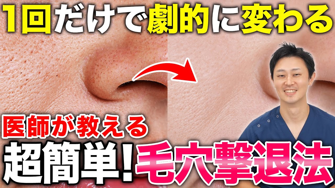 【毛穴改善】確実な効果があるスキンボトックスについて解説します