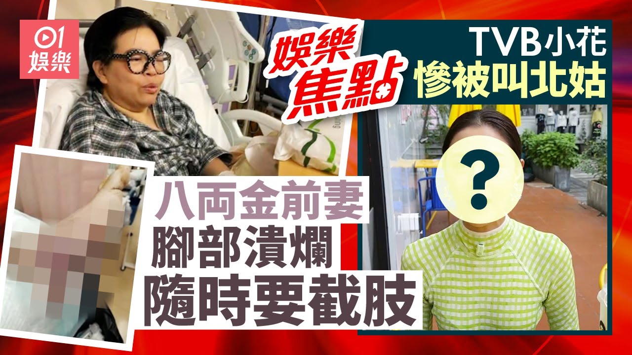前TVB幸運小花自爆被叫北姑親解廣東話沒進步原因求大家鬧少啲｜《東張西望》八両金前妻八両菜腳部潰爛發黑更隨時要截肢｜10月22日娛樂新聞 #今日娛樂 #香港01