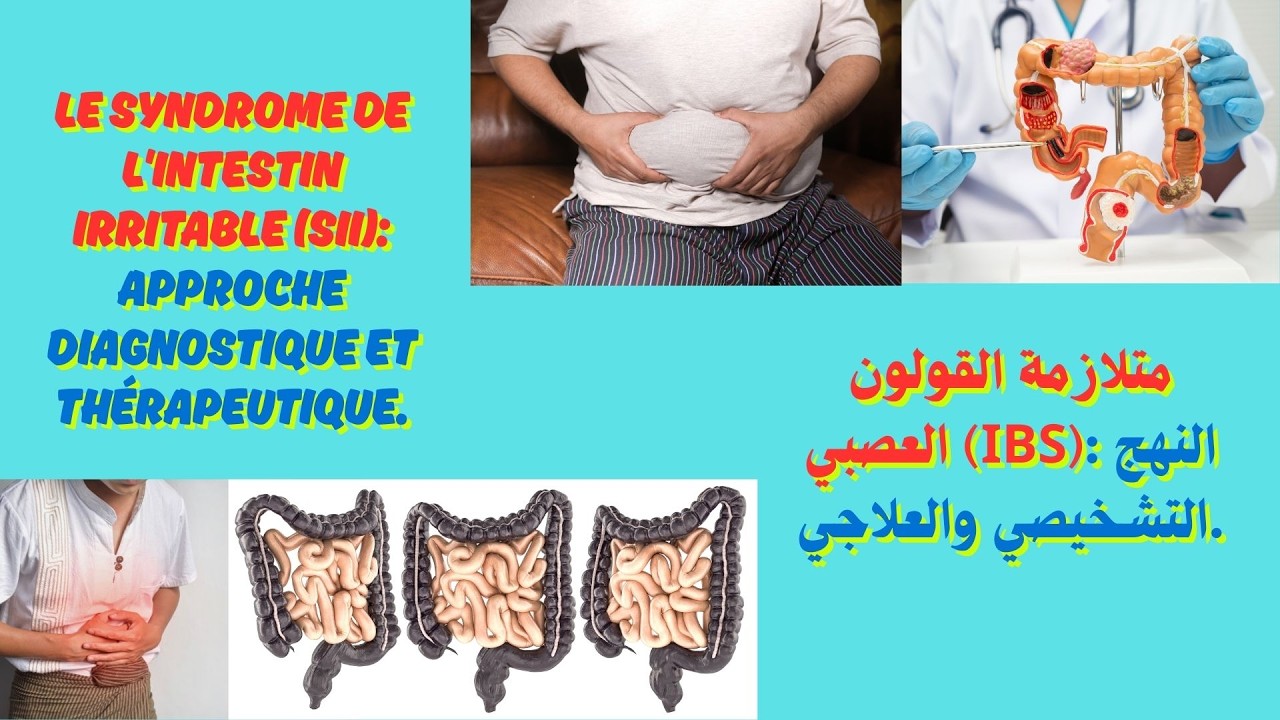 Le syndrome de l'intestin irritable SII  approche diagnostique et thérapeutique