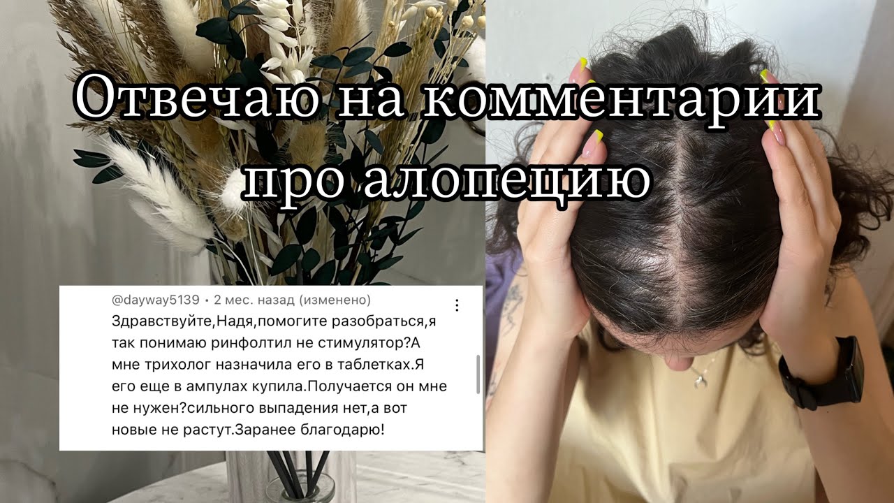 Отвечаю на комментарии про андрогенную алопецию