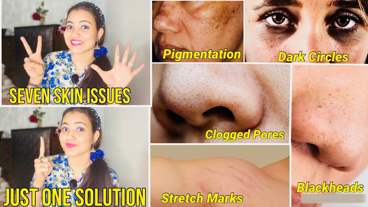1 Week Challenge to Fix 7 Skin Issues with Just One Ingredient. Dry Skin, Pigmentation And More.