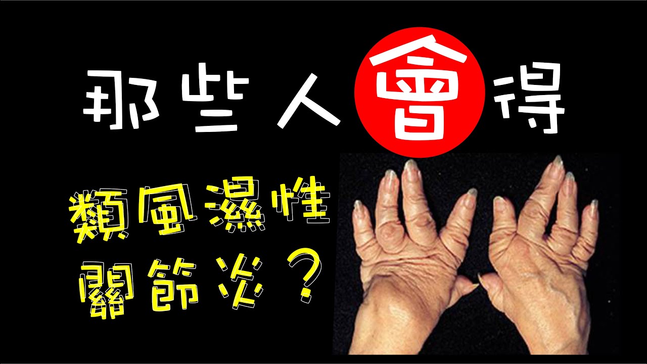 淺談類風溼關節炎