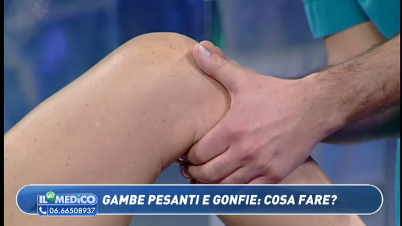 Il Mio Medico - Gambe pesanti e gonfie: cosa fare?