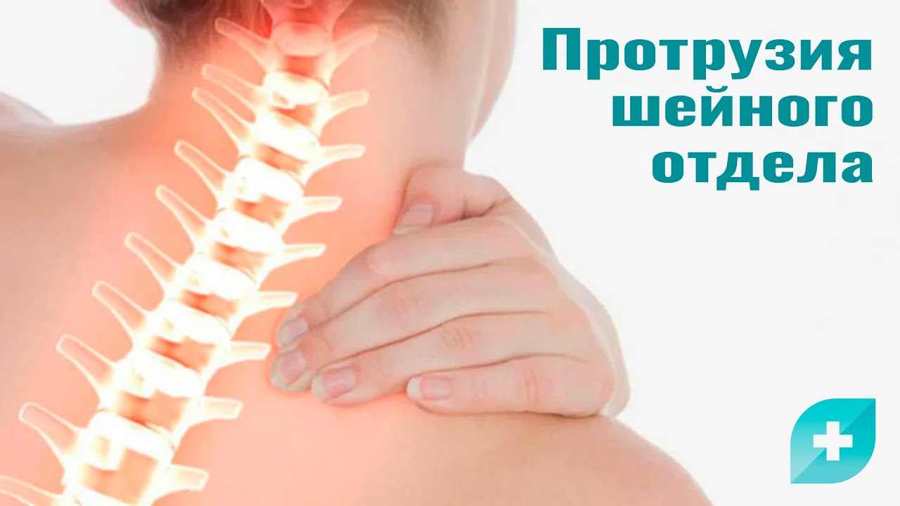 Протрузия шейного отдела: причины, симптомы и лечение