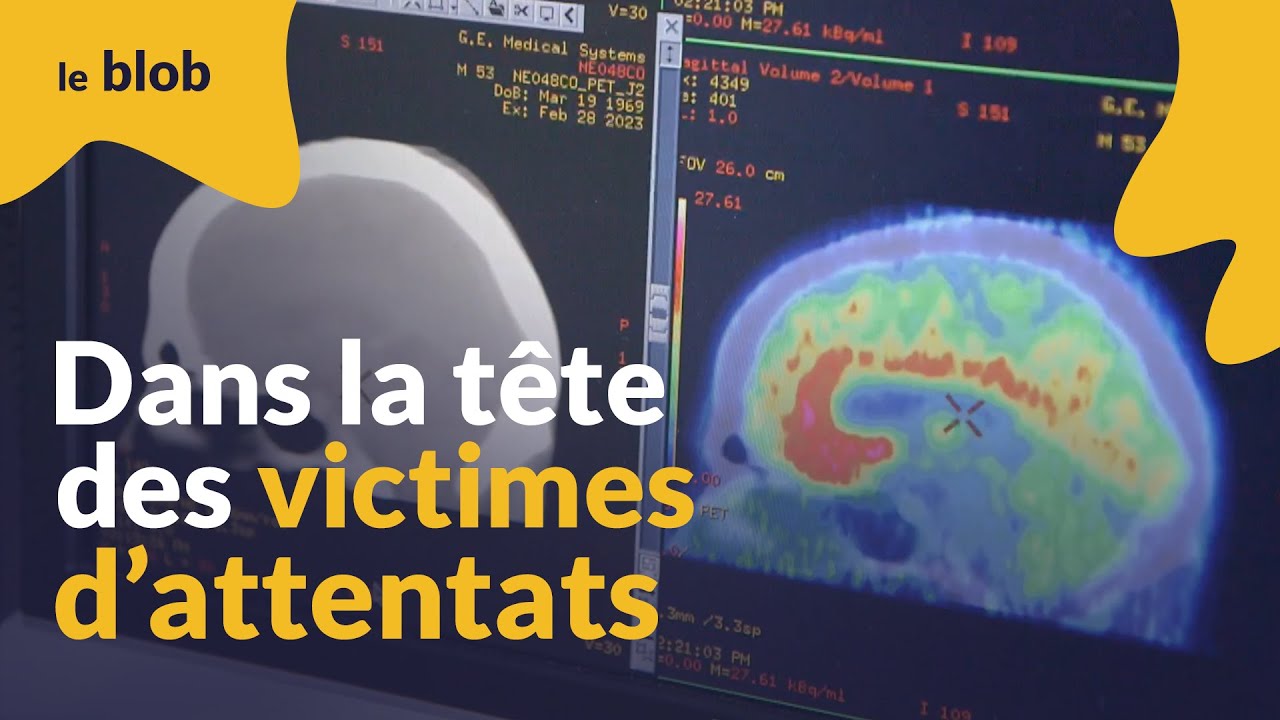 13 novembre : comprendre le stress post-traumatique pour concevoir un traitement | Reportage