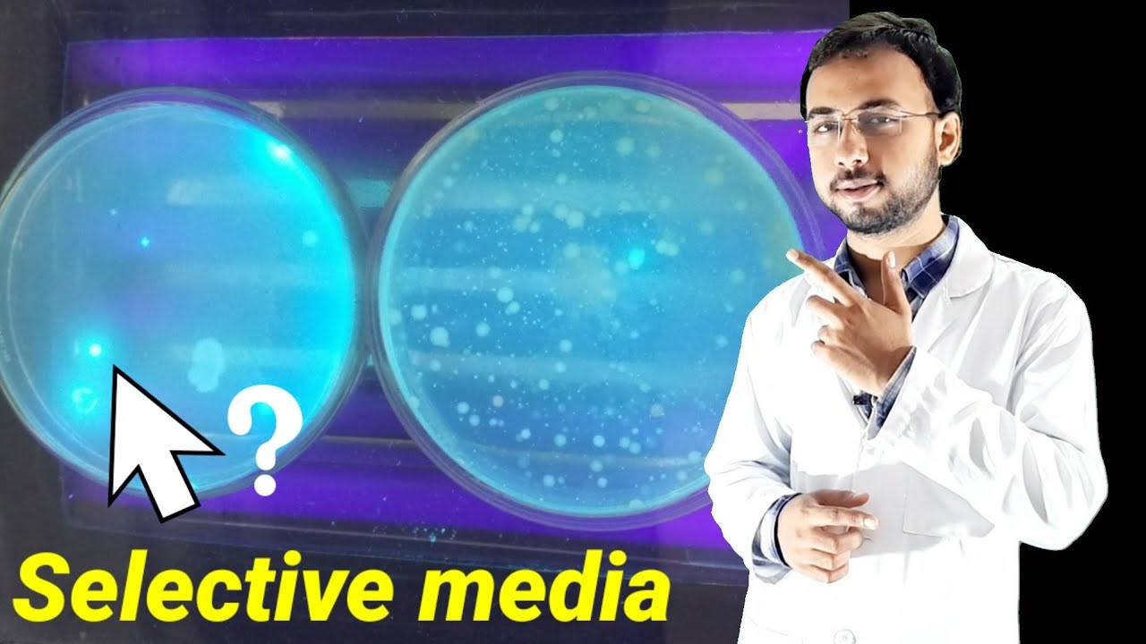 Selective media microbiology | EMB agar test | culture media microbiology | pseudomonas aeruginosa