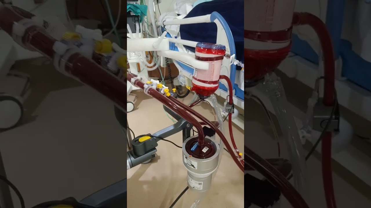 ECMO machine #hospital #medicalhealthcare #shorts #ecmo #ecmomachine #doctor #icudoctor #doctor